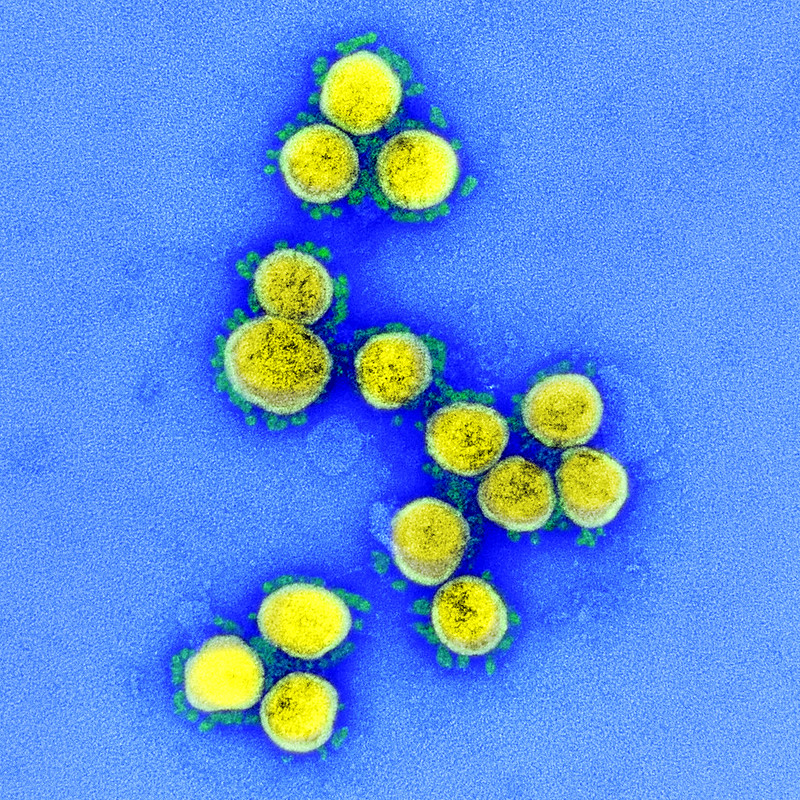 Novel+Coronavirus+SARS-CoV-2